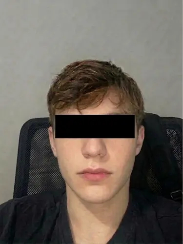 Escort Model Bunny Photos